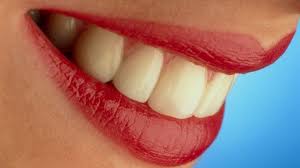 Teeth Whitening in Karachi is a very popular and common amongst cosmetic dental procedures at Rehan Dental Surgery