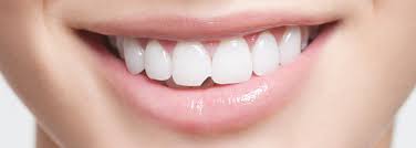 Dental Bonding at Rehan Dental Surgery Dental bonding is the application of a tooth-colored resin material using adhesives and a high intensity curing light. The procedure gets its name because materials are bonded to the tooth. 