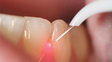 Orthodontics, Dental Implants, Root Canal Treatment, Gum disease Treatment, Crowns and bridges