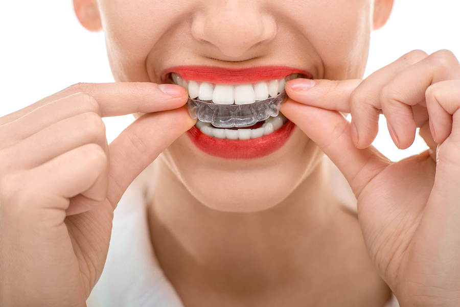 orthodontic-invisible-braces