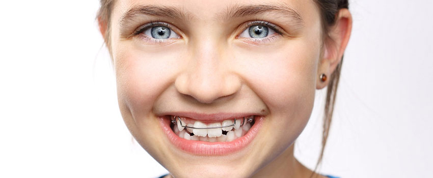 child-orthodontics