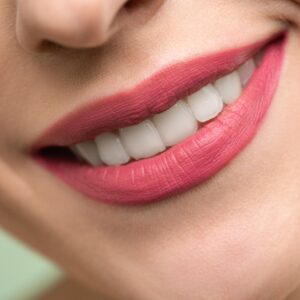 teeth-whitening-at-Rehan-Dental-Surgery